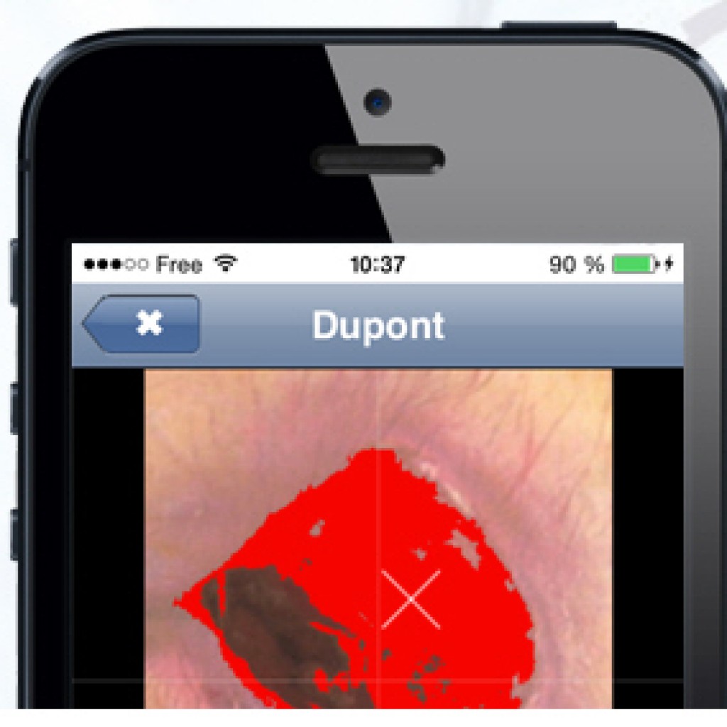 CUTAnet : logiciel de suivi de plaies