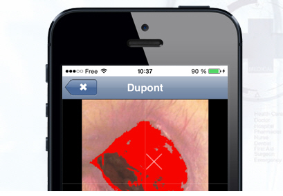 CUTAnet : logiciel de suivi de plaies