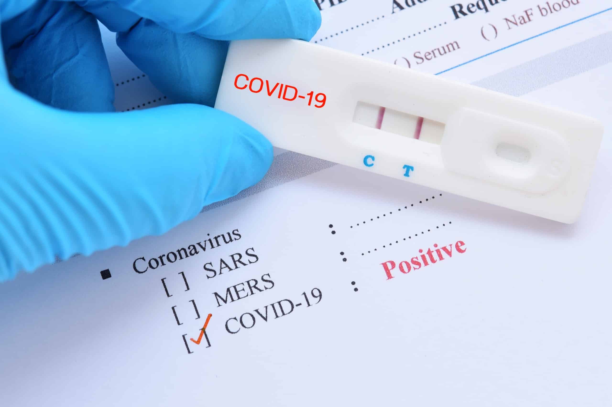 Covid19 et tests antigéniques positif ou négatif, les infirmiers