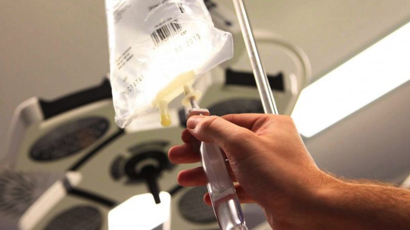 Perfusion 2